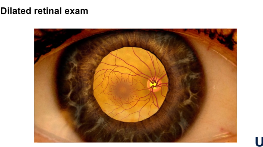 IDweek2023 | PRO: The Imperative of Dilated Retinal Exams in All Pediatric Patients with Candidemia