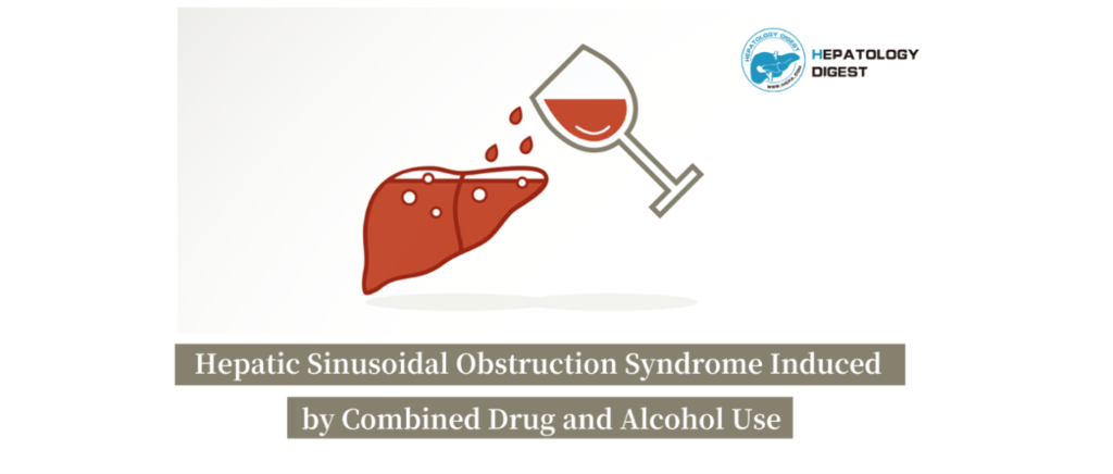 Case Sharing: A Case of Hepatic Sinusoidal Obstruction Syndrome Induced by Combined Drug and Alcohol Use