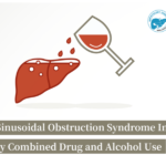 Case Sharing: A Case of Hepatic Sinusoidal Obstruction Syndrome Induced by Combined Drug and Alcohol Use