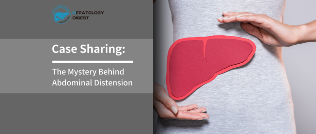 Case Sharing: The Mystery Behind Abdominal Distension