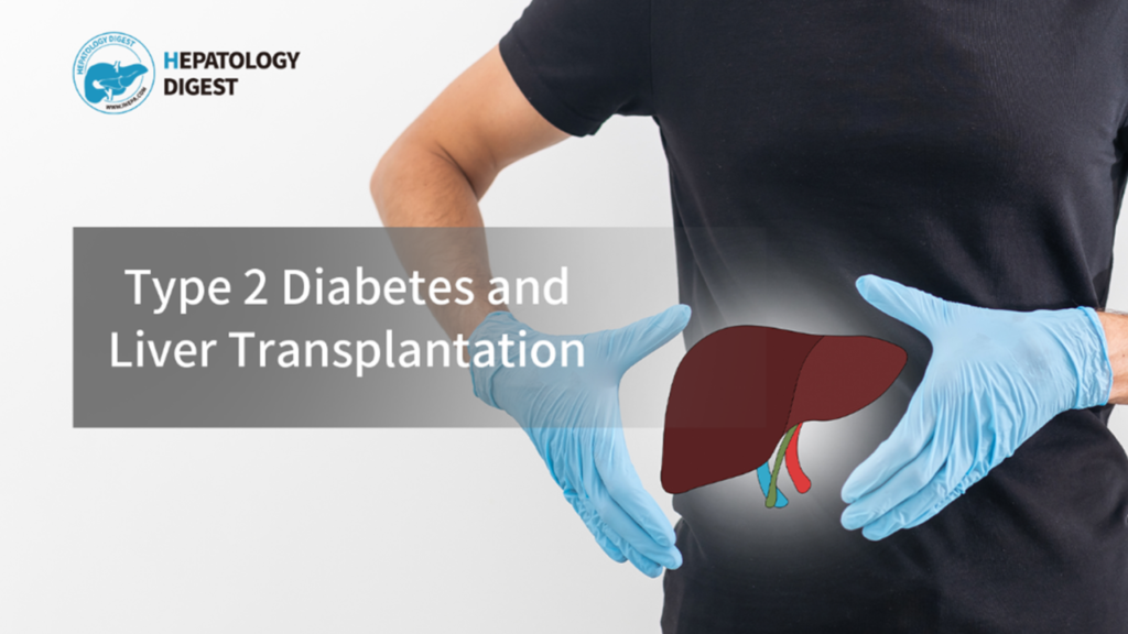Type 2 Diabetes as a Significant Factor Increasing Mortality After Liver Transplantation