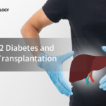 Type 2 Diabetes as a Significant Factor Increasing Mortality After Liver Transplantation