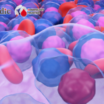 The 5th Lymphoma & Myeloma Immunotherapy and Targeted Therapy Conference | Dr. Kai Fu Discusses Research Progress and a New Prognostic Model in the North American Mantle Cell Lymphoma Program (NAMCLP) 