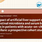 Artificial Liver Support System Improves Gut Microbiota and Serum Bile Acids in Patients with Acute-on-Chronic Liver Failure