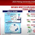 CAR-T Therapy in Advanced Prostate Cancer: Insights from Prof. Shancheng Ren, Shanghai Changzheng Hospital