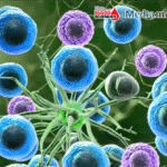 Blood Science Update | Advancing the Diagnosis and Management of Primary Vitreoretinal Lymphoma: New Insights and Future Perspectives