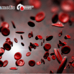 Blood Science Update|A Prognostic Analysis of Acute Leukemia Patients With Prior CNS Involvement Undergoing Umbilical Cord Blood Transplantation