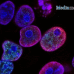 Adv Sci | MARCO⁺ Tumor-Associated Macrophages Drive Immunotherapy Resistance in Renal Cell Carcinoma